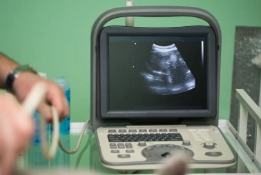 Ultrasound